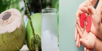 Coconut water for kidneys Fresh water is an easy solution for kidney stone problem