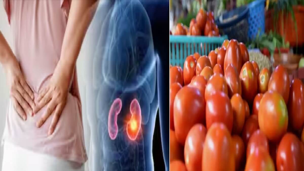 Tomato Side Effects: Those with kidney stone problems should not eat tomatoes