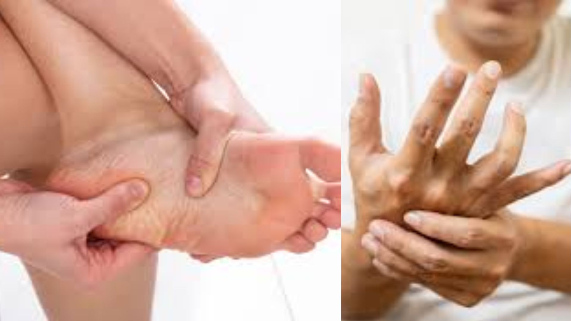 Guillain Barré Syndrome GBS