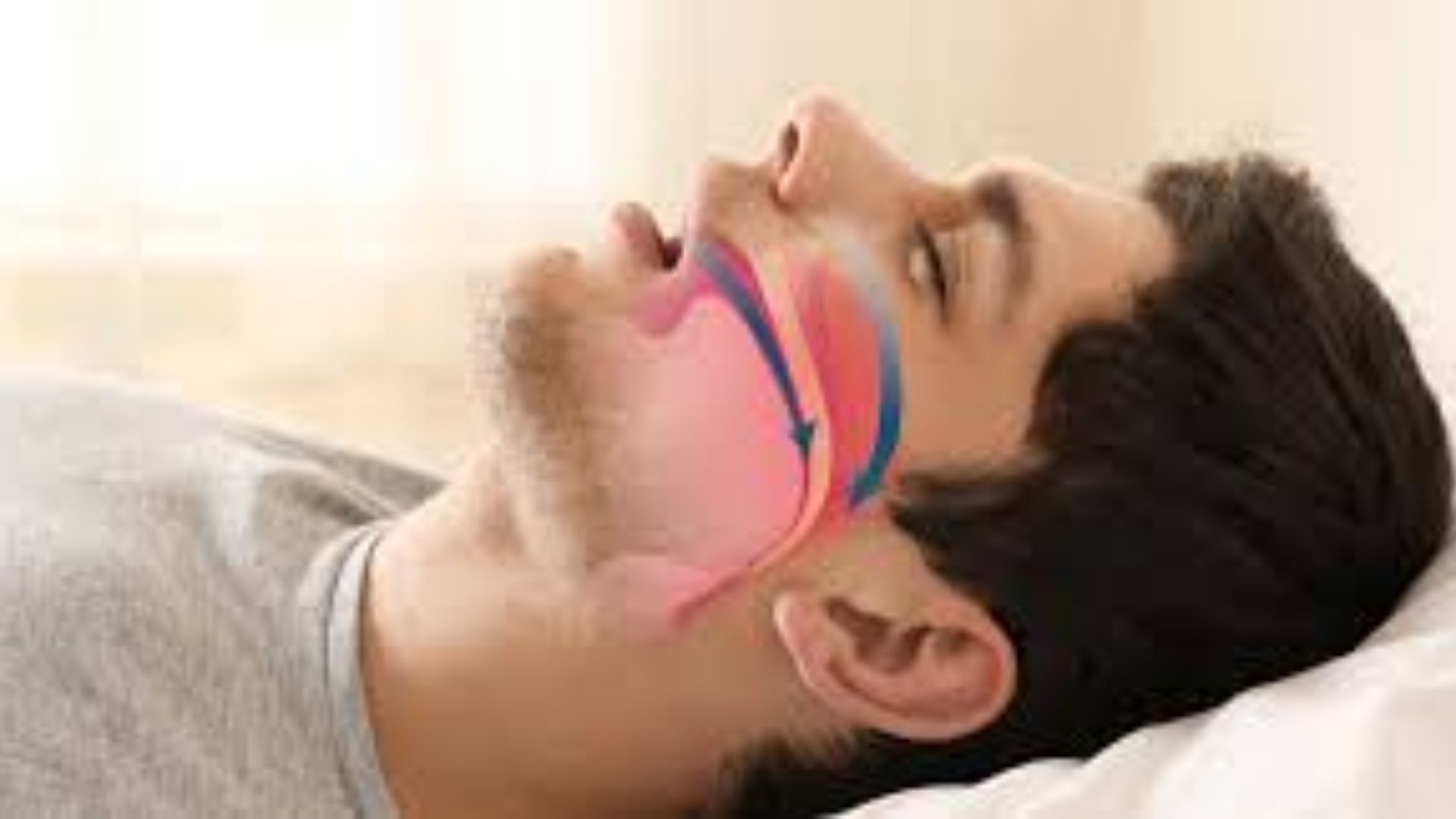 Mouth Breathing Health Issues