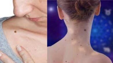 lucky moles on a female body and their hidden meanings