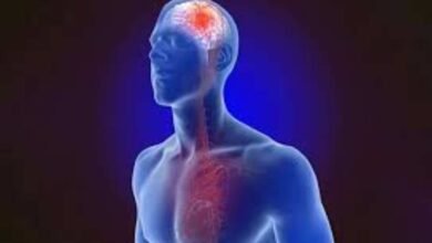 dont neglect mini stroke it may Transient Ischemic Attack