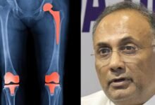 knee hip replacement in government hospital