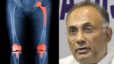 knee hip replacement in government hospital