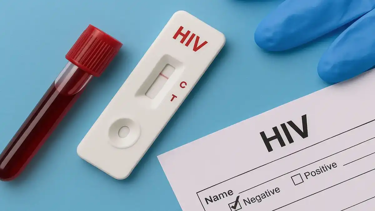 HIV Test : ಯುವ ಜನತೆಗೆ ಎಚ್‌ಐವಿ ಅಪಾಯ : ಎಲ್ಲಾ ಕಾಲೇಜುಗಳಲ್ಲಿ ತಪಾಸಣೆ ಕಡ್ಡಾಯ