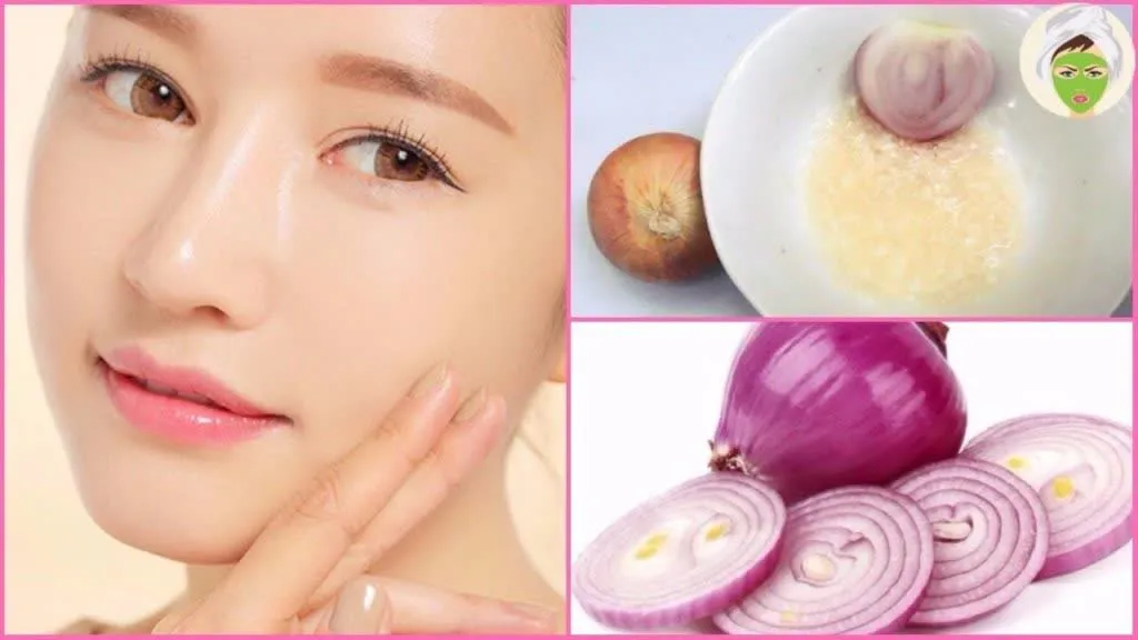 Onion 3