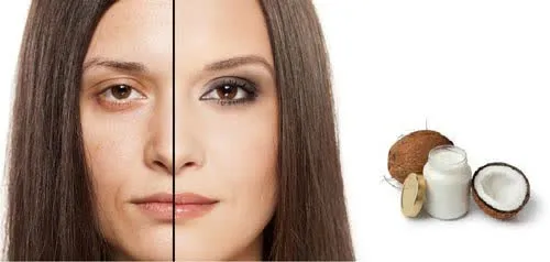 Skin Coconut 1